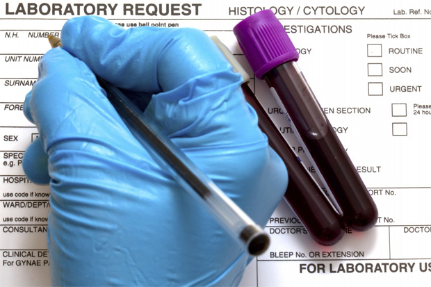Лаборант в синих медицинских перчатках записывает результаты анализа крови